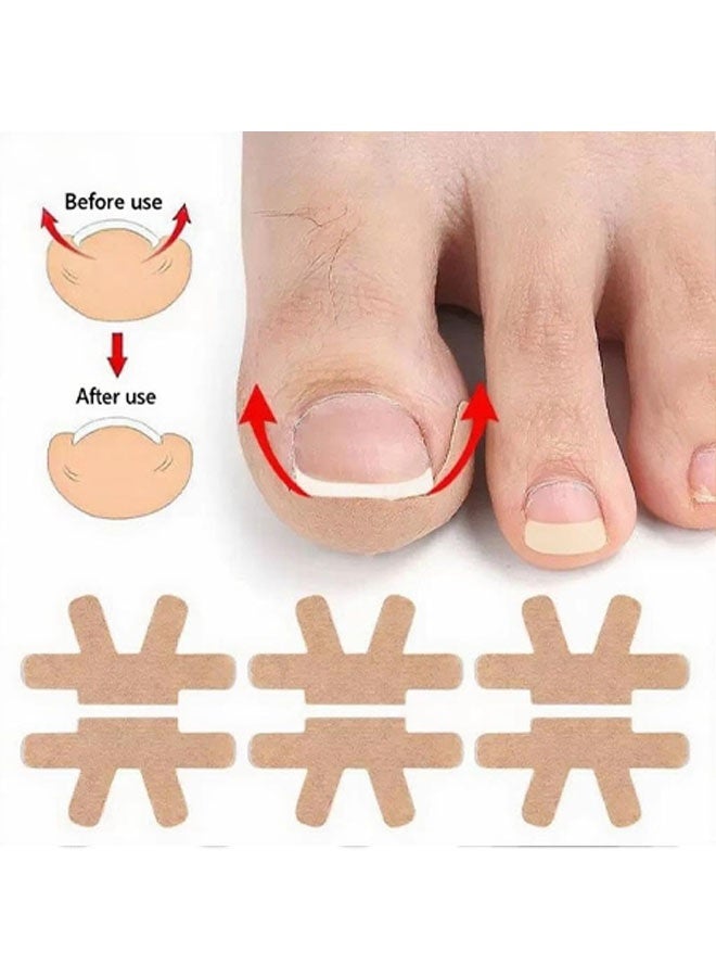 ٢٠ قطعة لعلاج الأظافر الناشبة، شرائط مسامية للأظافر الناشبة، أداة غير مؤلمة لإزالة الأظافر الناشبة والعناية بها، حل للعناية بالقدمين في المنزل - Image 3